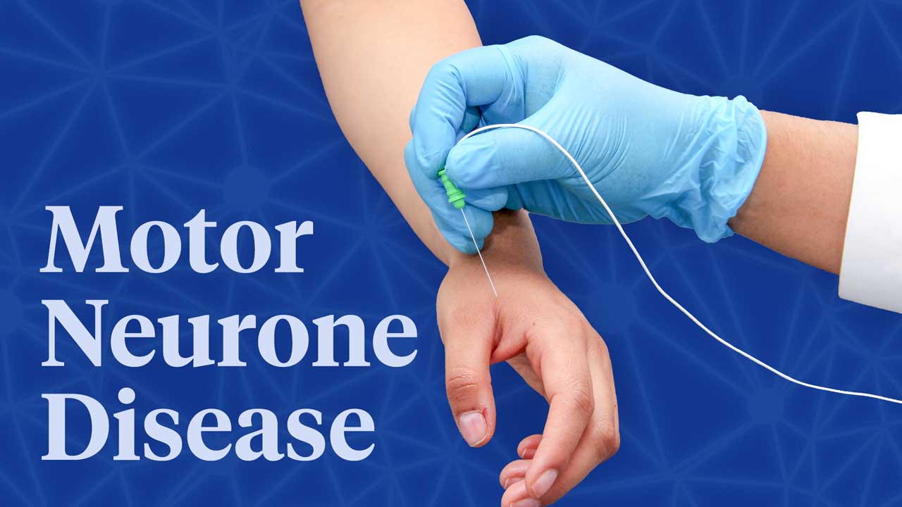 Cover image for: Nursing Care of Motor Neurone Disease (MND)