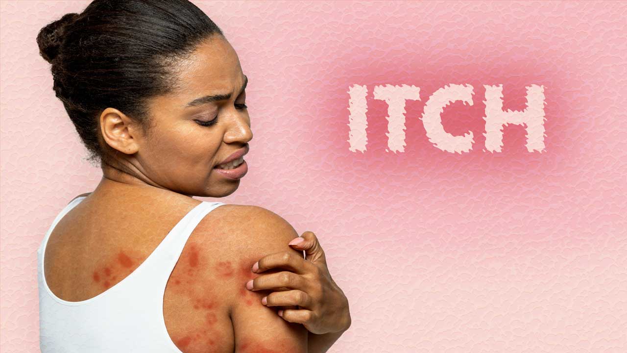Cover image for: Assessing and Treating Itch