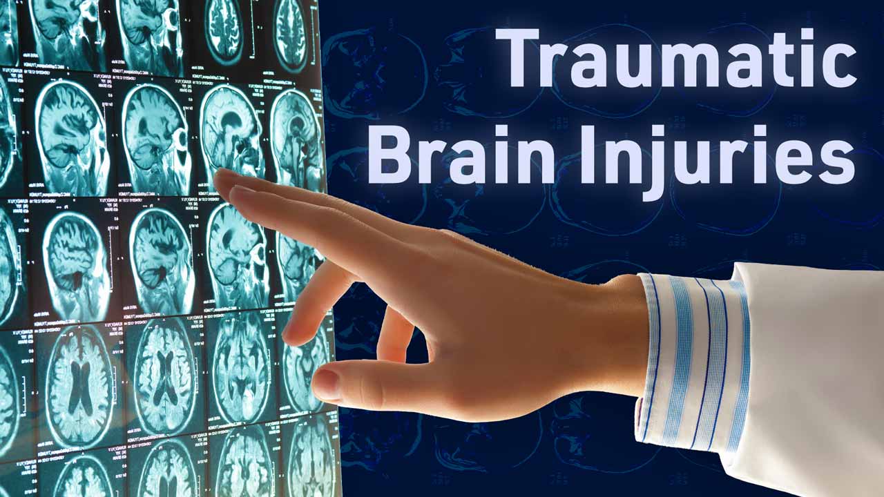 Cover image for: Traumatic Brain Injuries
