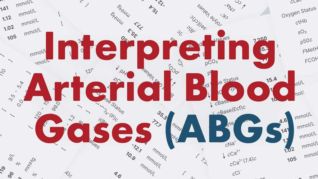 Cover image for: Interpreting ABGs (Arterial Blood Gases) Made Easy