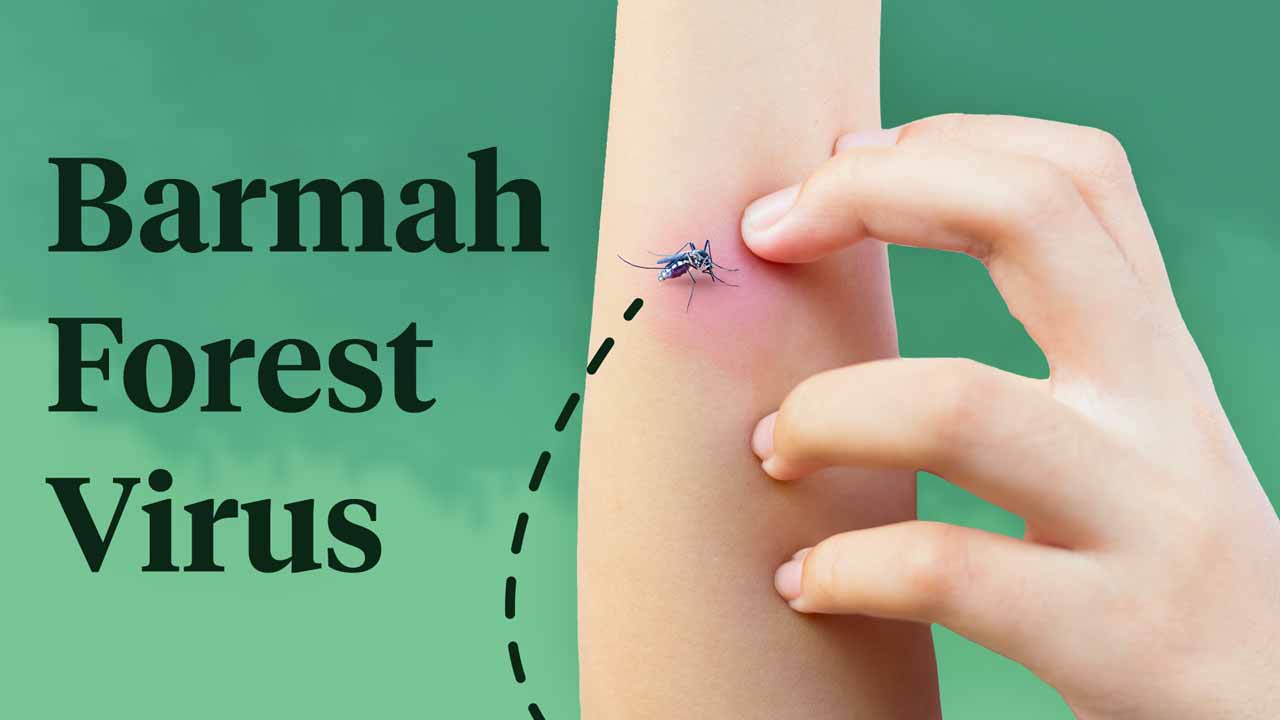 Cover image for: Barmah Forest Virus Infection