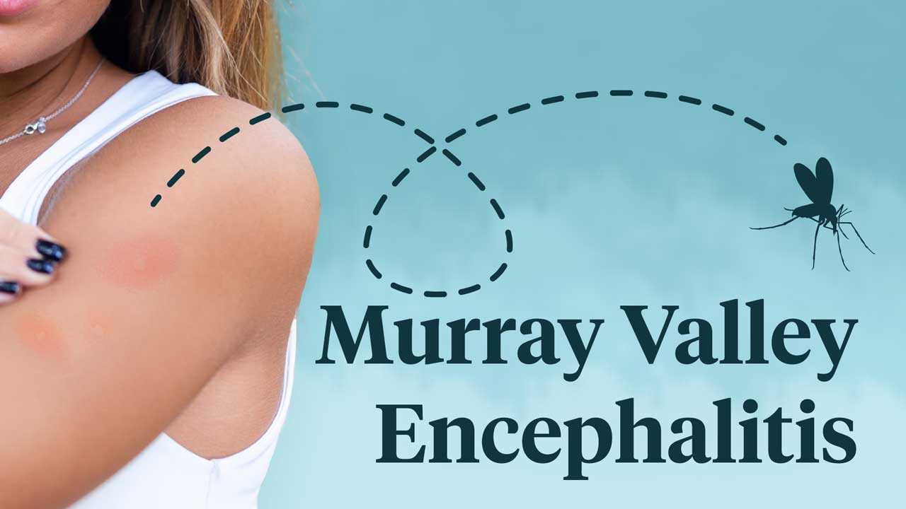 Cover image for: Murray Valley Encephalitis