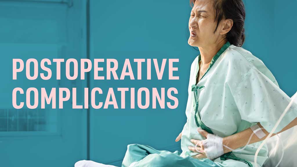 Cover image for: Postoperative Complications: Clinical Guidelines for Nurses