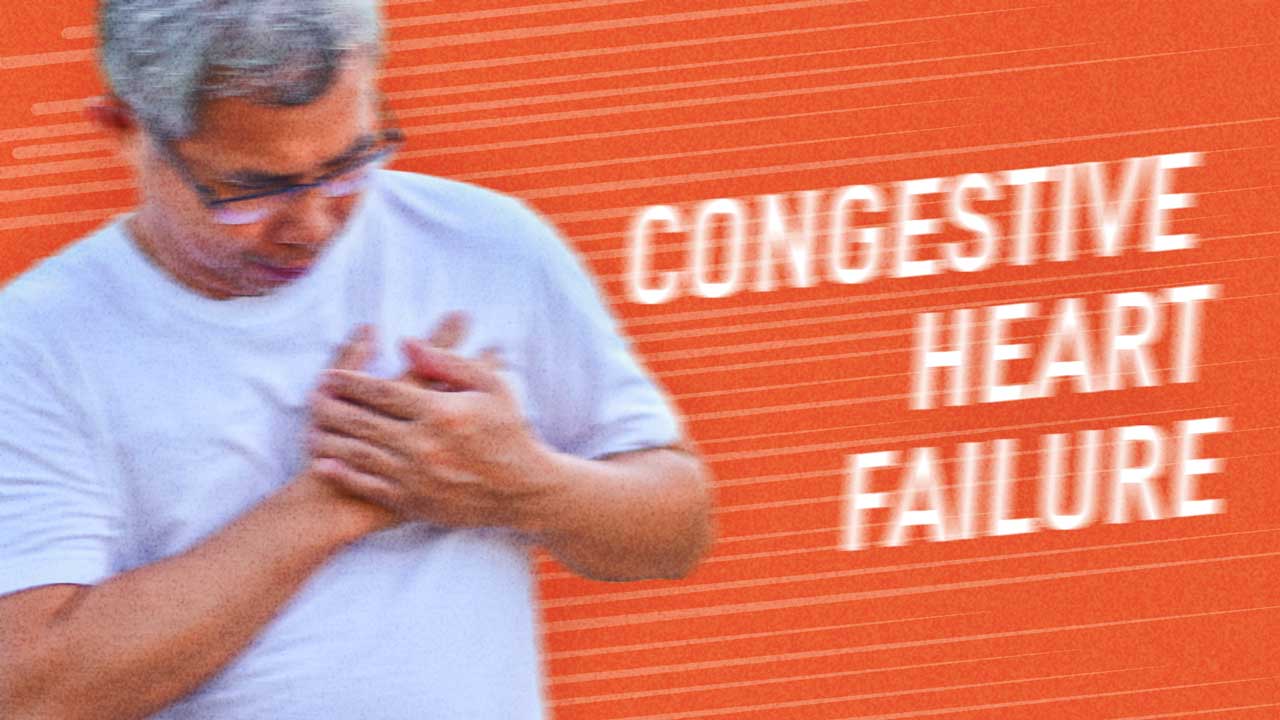Cover image for: Congestive Heart Failure: Common Reasons for CHF