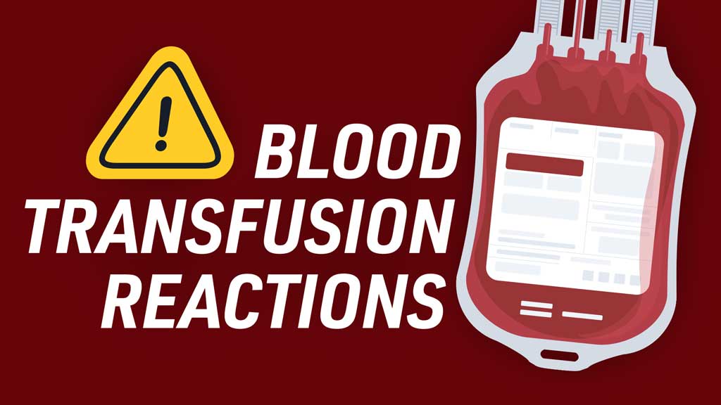 Cover image for: Blood Transfusion Reactions