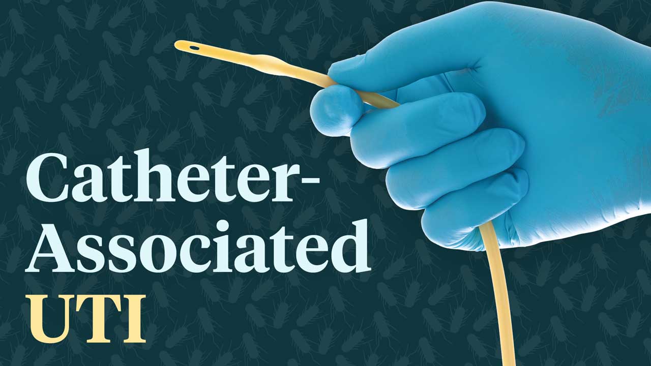 Cover image for: Catheter-Associated Urinary Tract Infections: How Do You Prevent CAUTI?