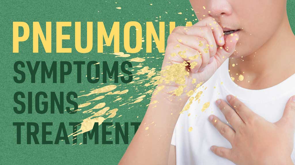 Cover image for: Pneumonia Symptoms, Signs and Treatment