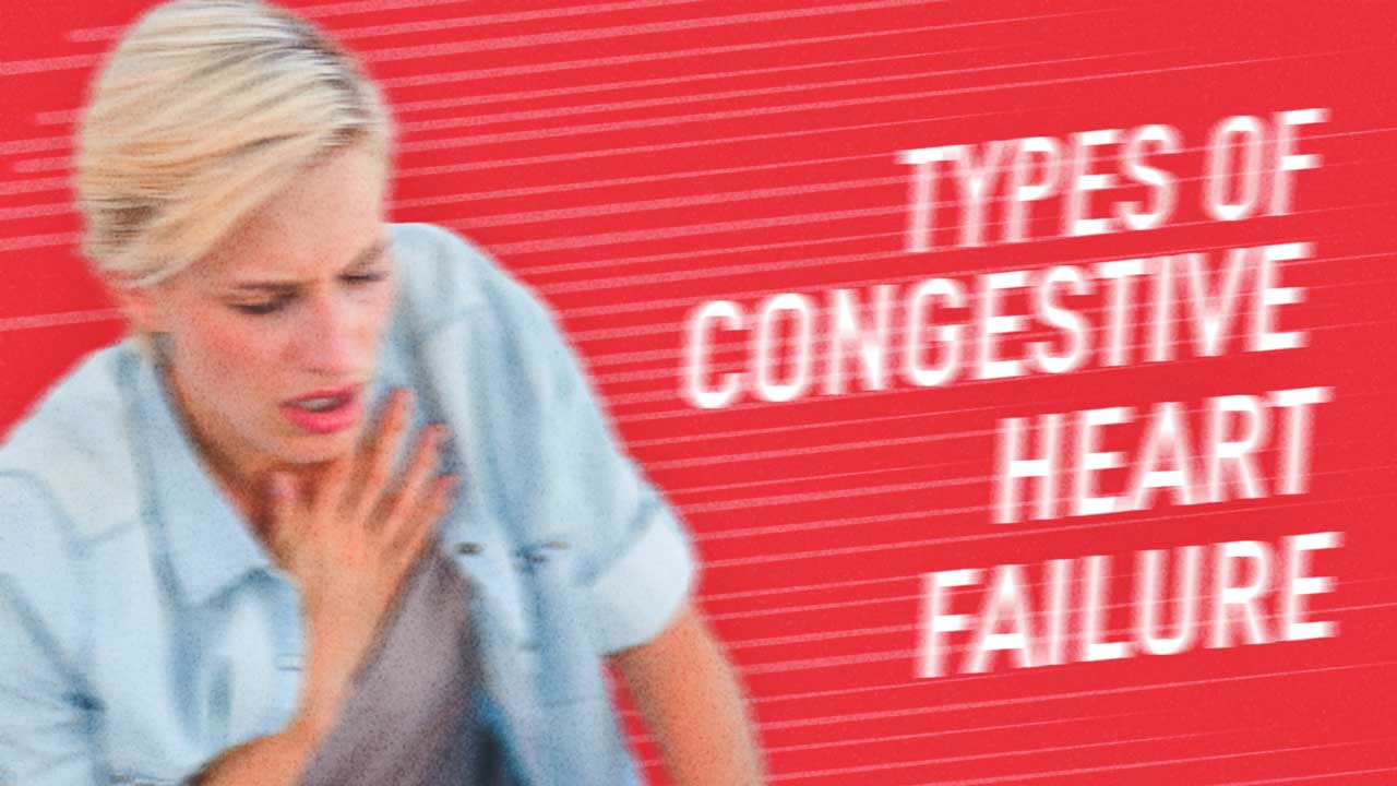 Cover image for: Types of Congestive Heart Failure