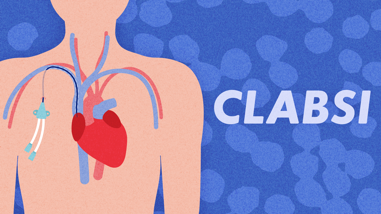 Image for Central Line-Associated Bloodstream Infections (CLABSI)