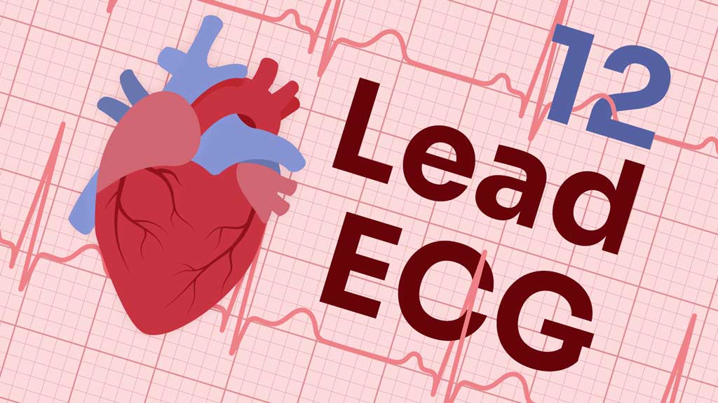 Cover image for: 12-Lead ECG Placement