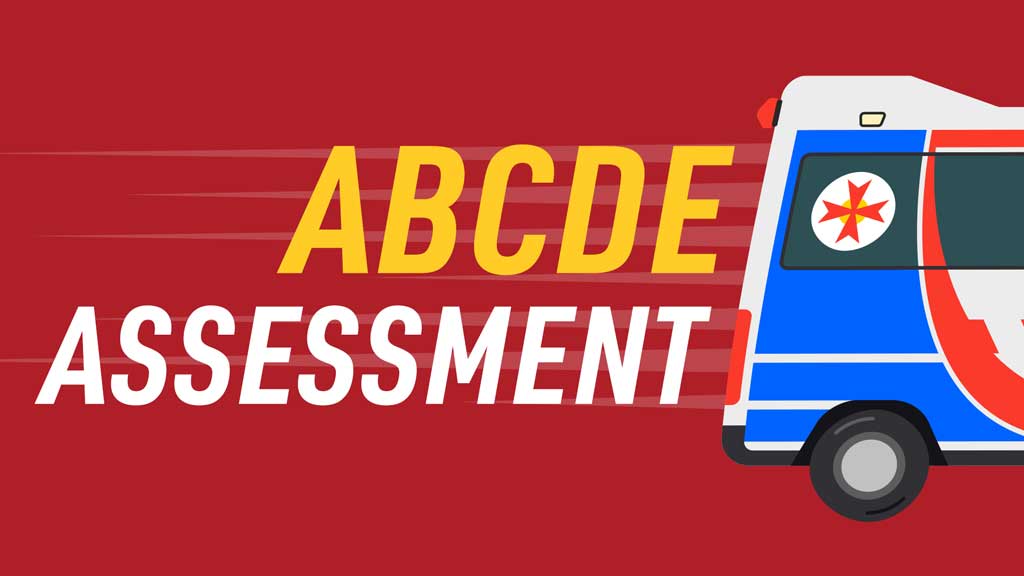 Cover image for: How To Assess a Deteriorating / Critically Ill Patient (ABCDE Assessment)