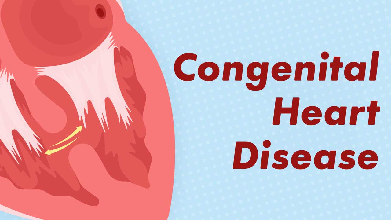 Cover image for: Understanding Congenital Heart Disease