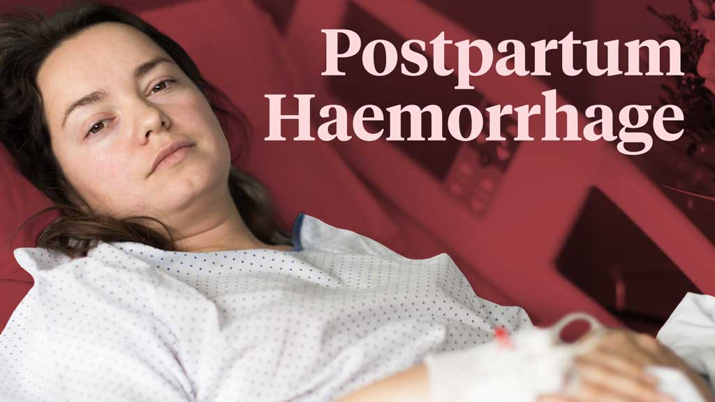 Cover image for: Postpartum Haemorrhage and Fundal Massage