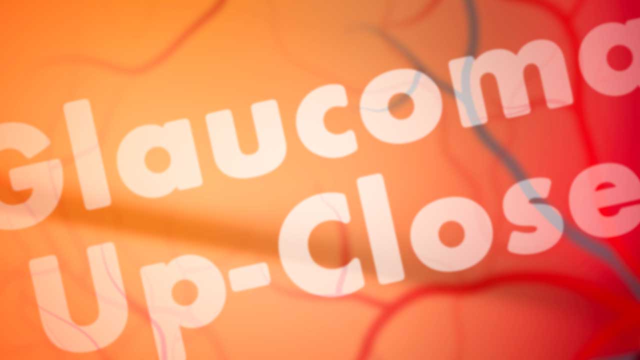 Cover image for: Glaucoma Up-Close