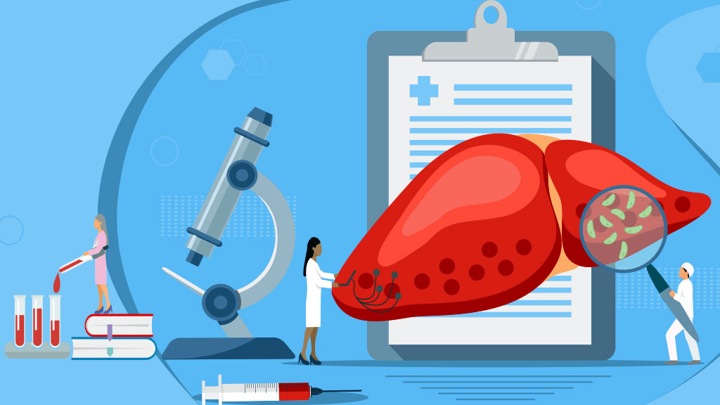 Image for Hepatitis C