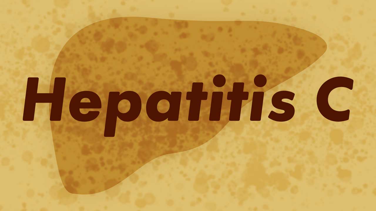 Cover image for: Hepatitis C Virus (HCV)