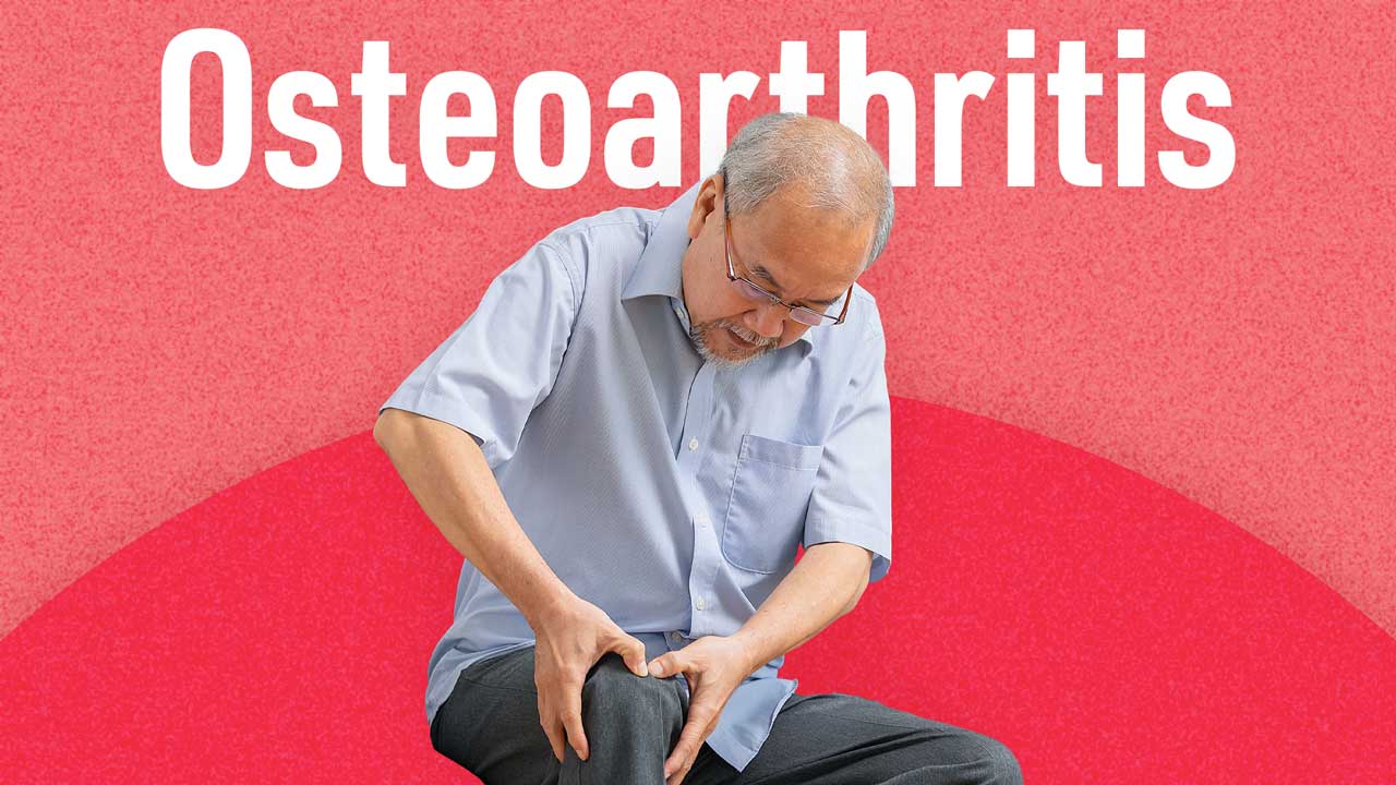 Cover image for: Osteoarthritis Care and Management