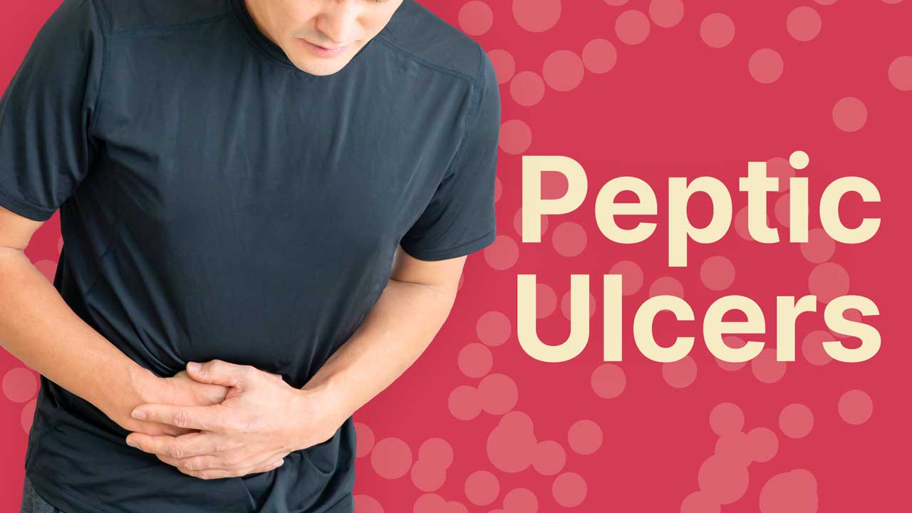 Cover image for: Peptic Ulcers: Types, Symptoms and Treatment