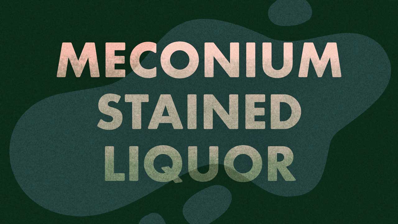 Cover image for: Assessing the Risks of Meconium-stained Liquor