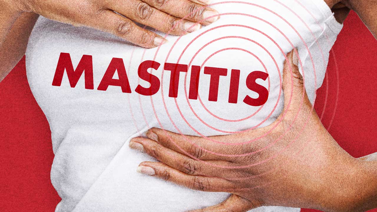 Cover image for: Managing Mastitis