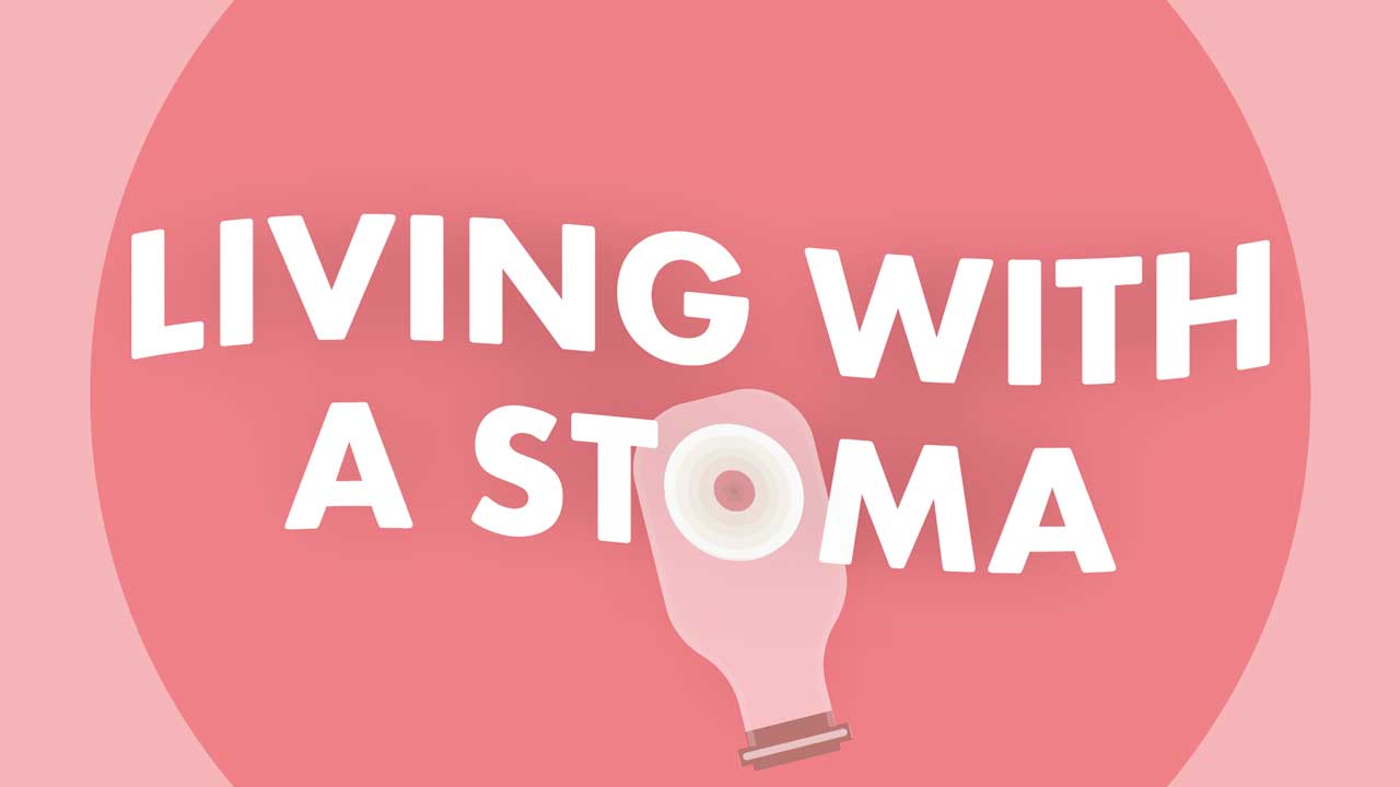 Cover image for: Living Well With a Stoma