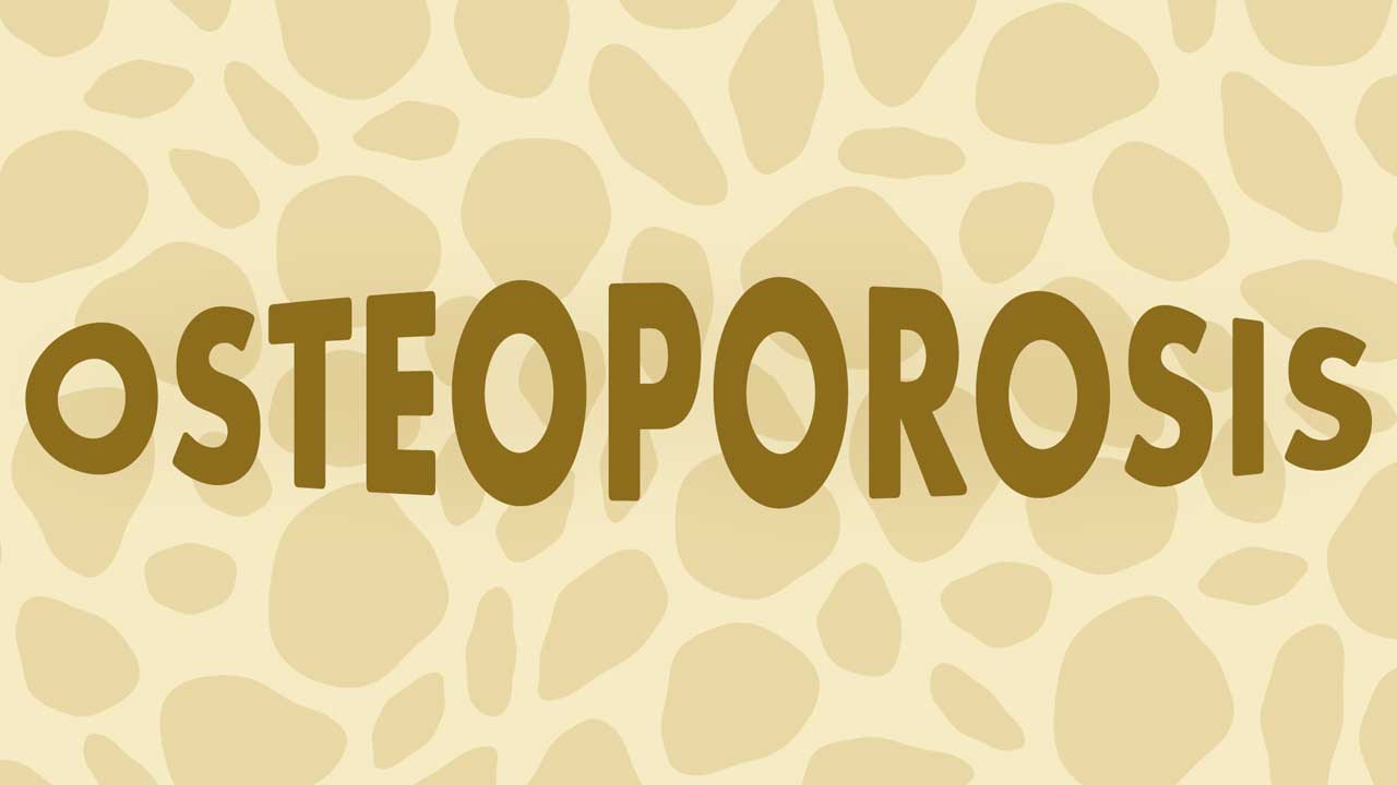 Cover image for: An Overview of Osteoporosis