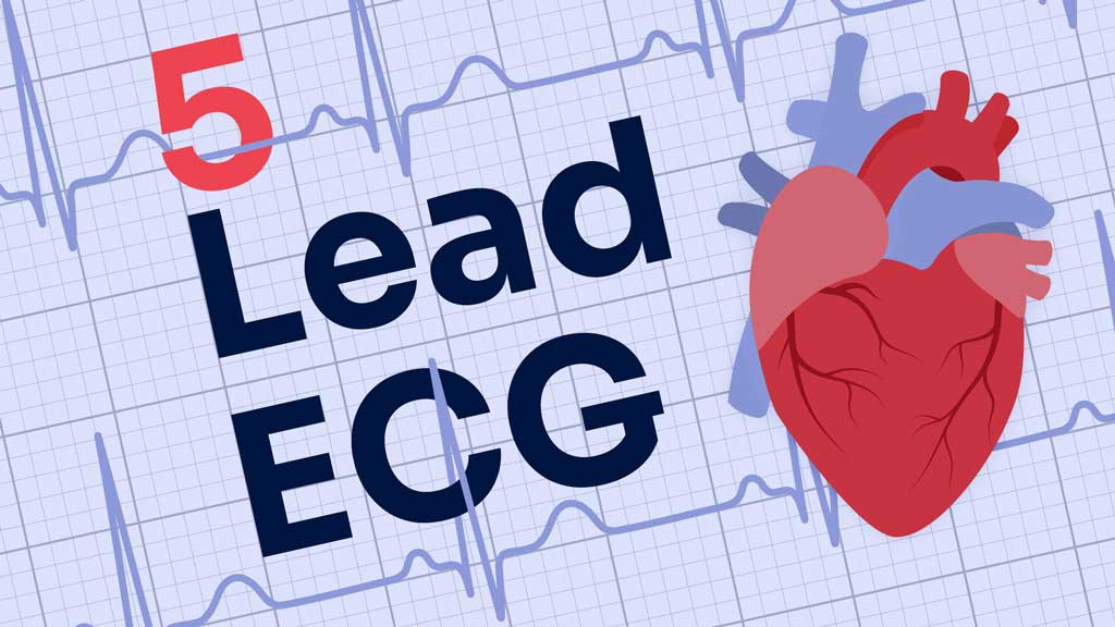 Cover image for: 5-Lead ECG Placement and Cardiac Monitoring