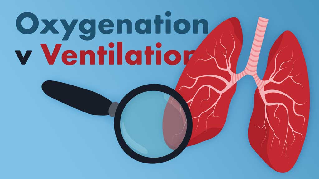 Cover image for: A Recap of Oxygenation v Ventilation