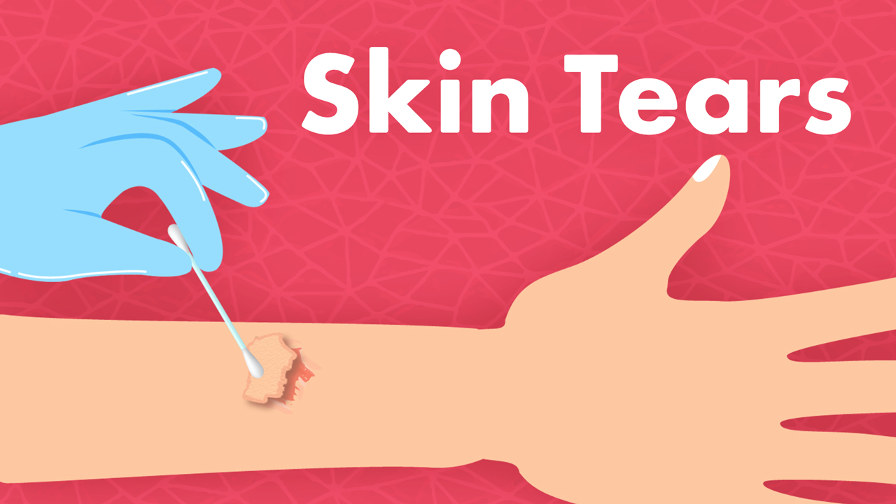 Image for Skin Tear Prevention and Management