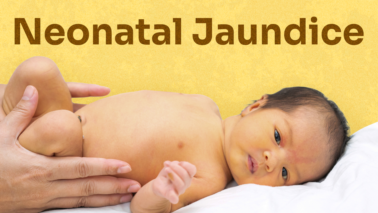 Cover image for: Managing Neonatal Jaundice at Home