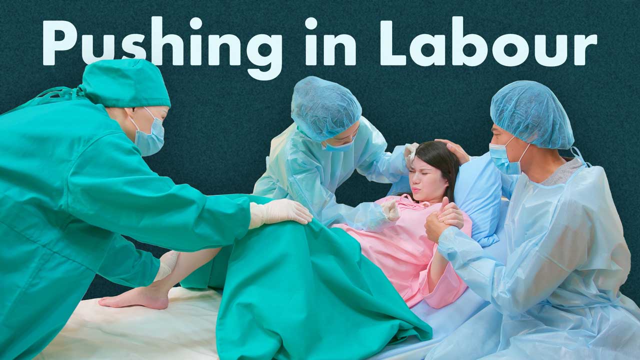 Cover image for: Spontaneous v Directed Pushing in Labour