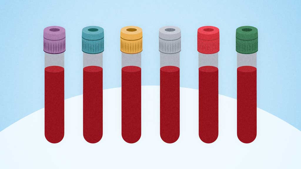 Cover image for: Venepuncture: Phlebotomy and IV Cannula Insertion