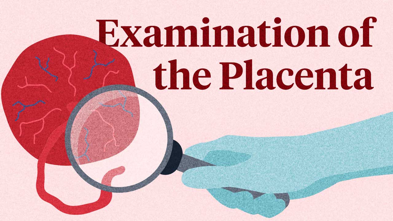 Cover image for: Examination of the Placenta