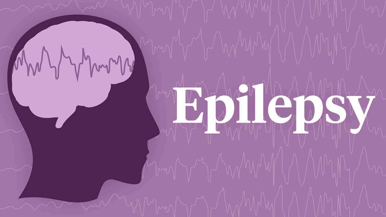 Cover image for: Epilepsy Overview and Care