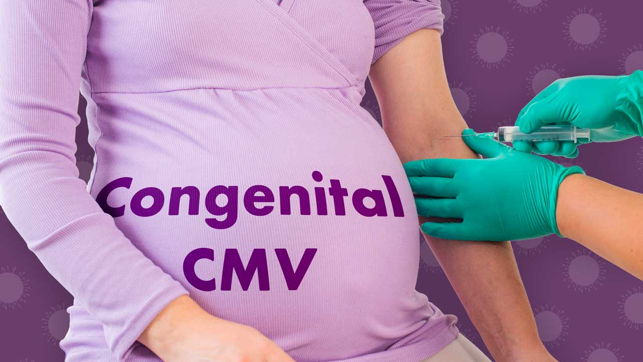 Cover image for: Congenital Cytomegalovirus (CMV): Reducing the Risk