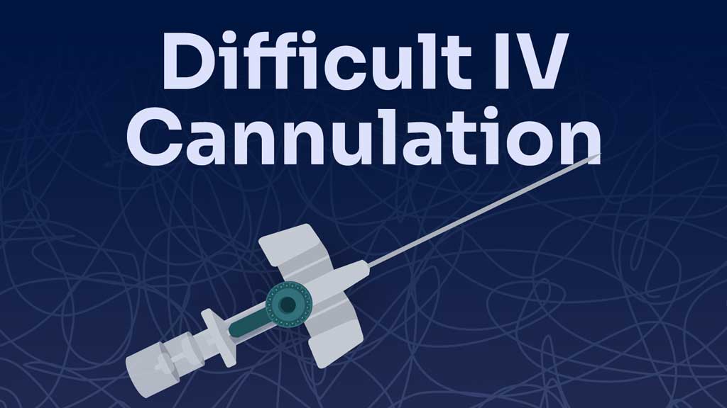 Cover image for: Managing Difficult IV Cannulation