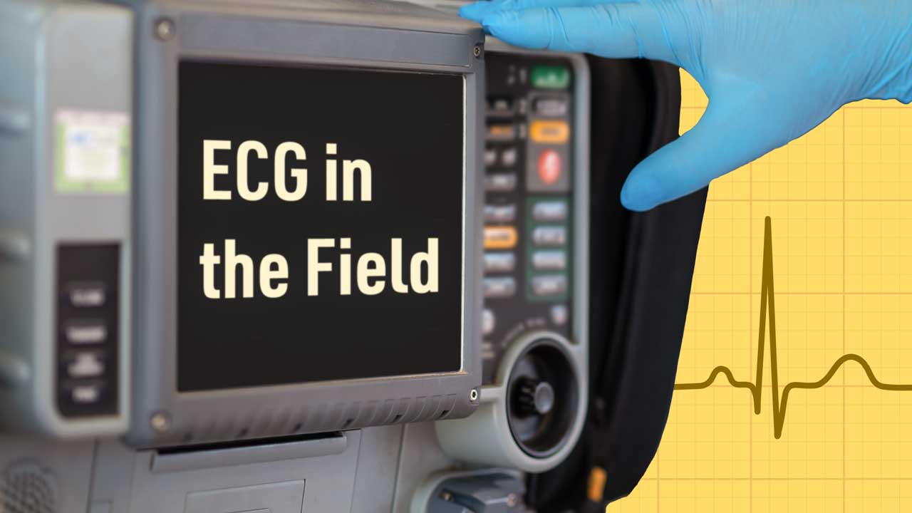 Cover image for: 12-Lead ECG in the Field