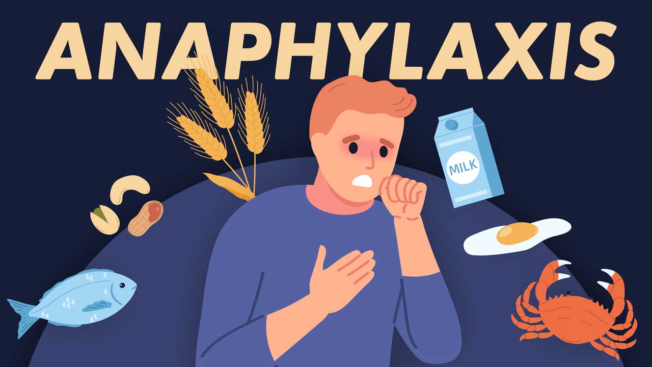 Cover image for: Recognising and Treating Acute Anaphylaxis