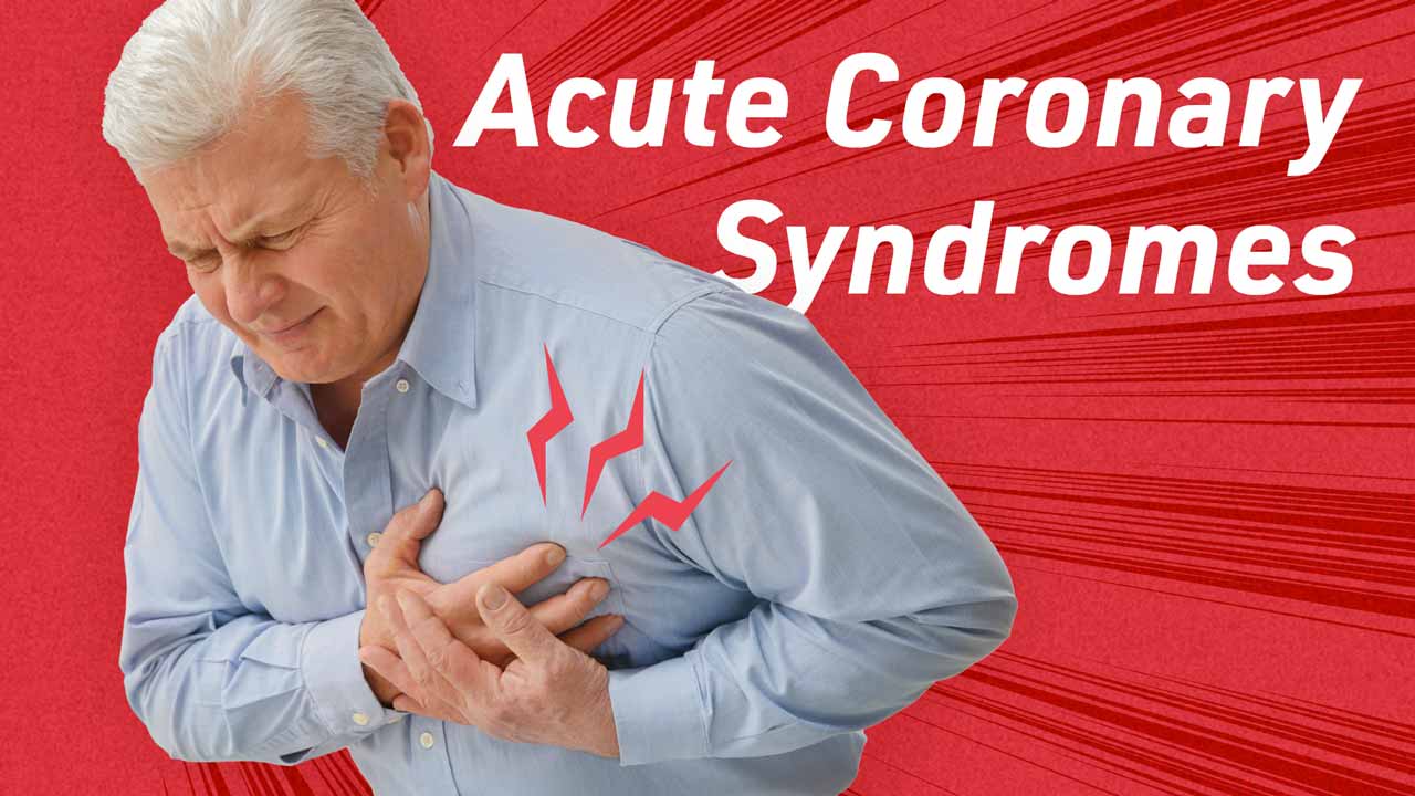 Cover image for: Clinical Management of Acute Coronary Syndromes