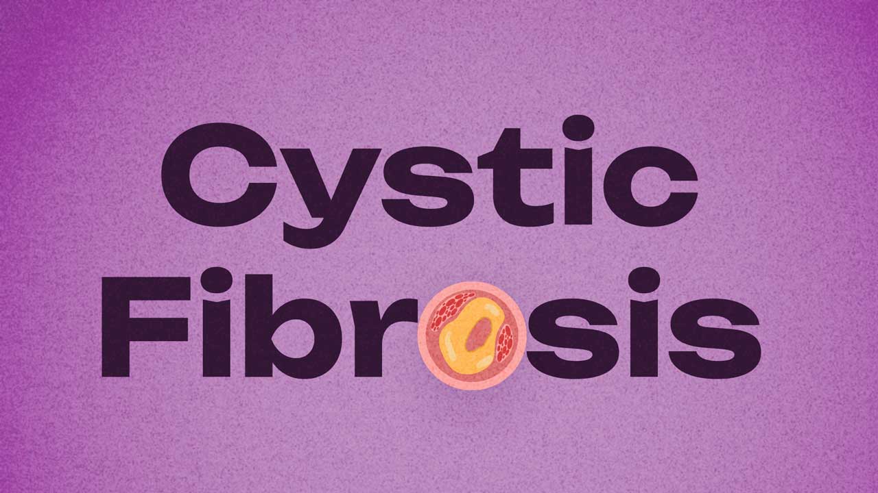Cover image for: Symptoms and Treatment of Cystic Fibrosis