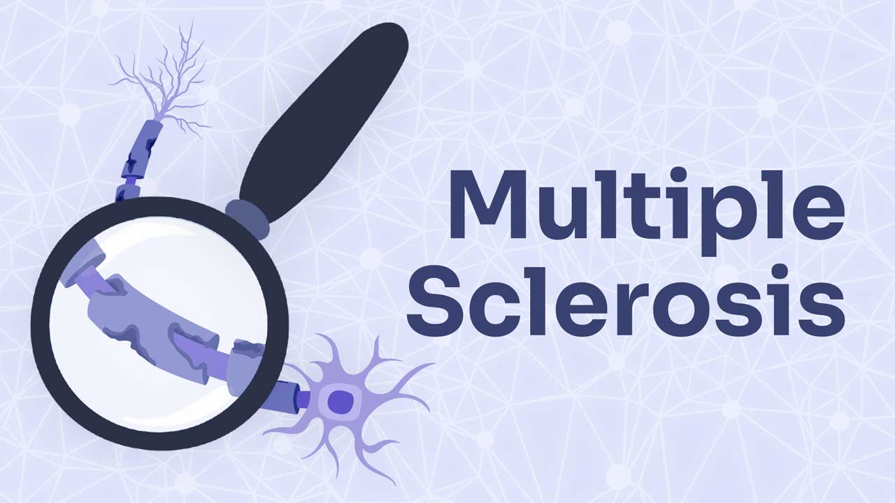 Cover image for: How Does Multiple Sclerosis Affect the Body?