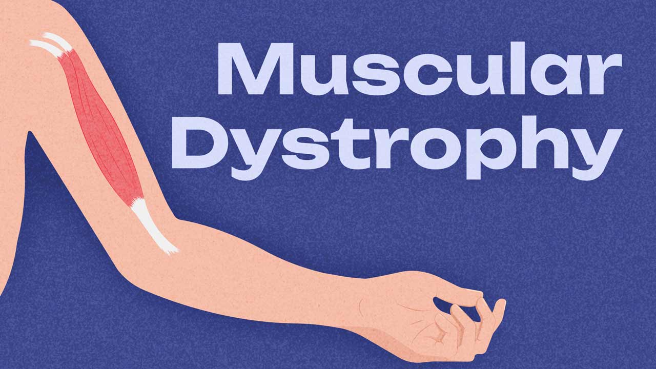 Image for Types of Muscular Dystrophy