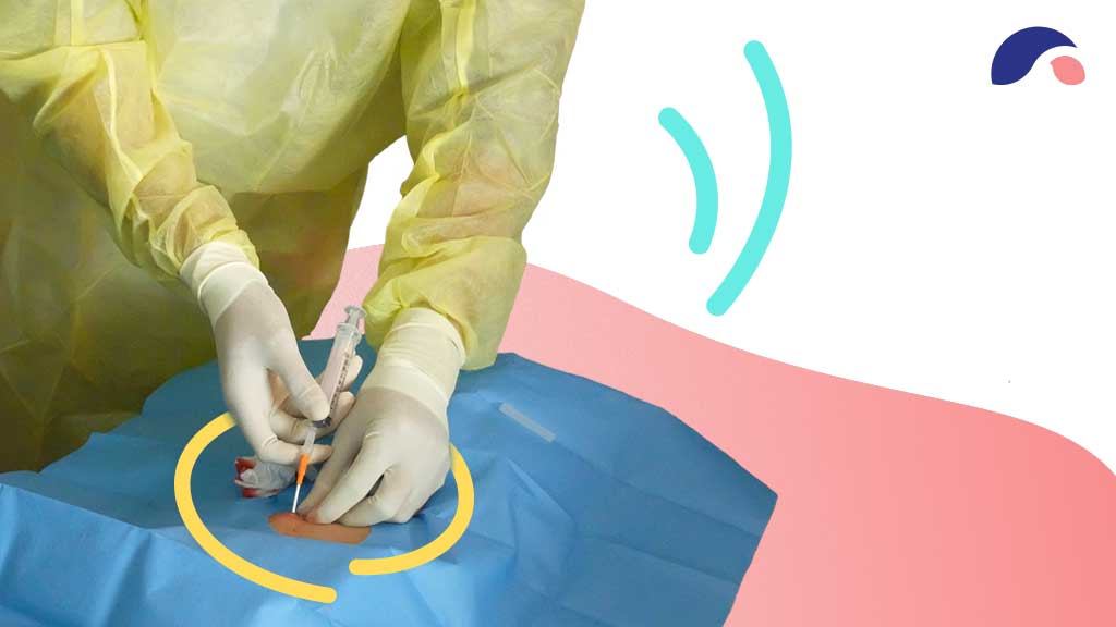 Cover image for: Percutaneous Endoscopic Gastrostomy (PEG) Site Care