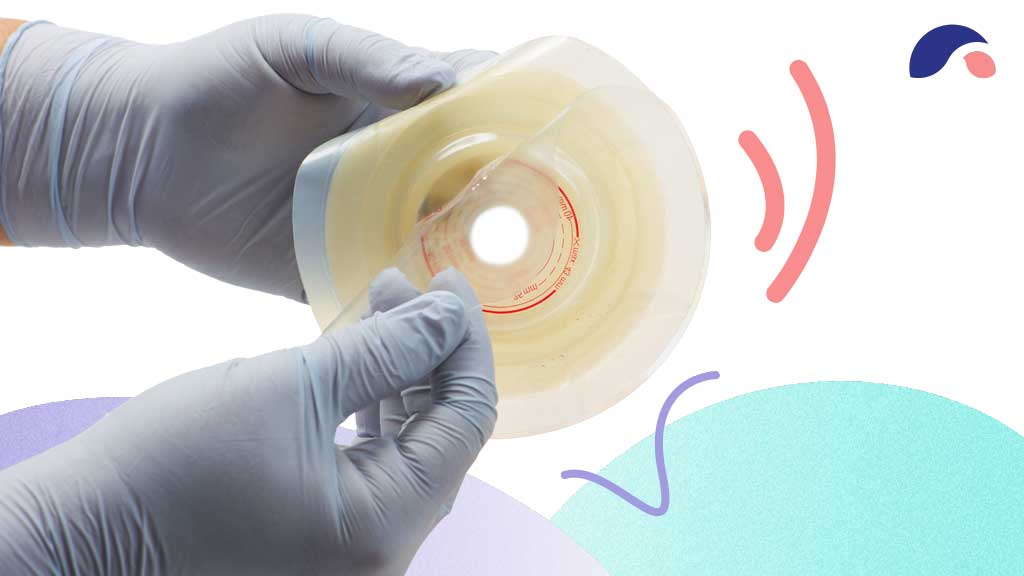 Cover image for: Stoma Care in the Home
