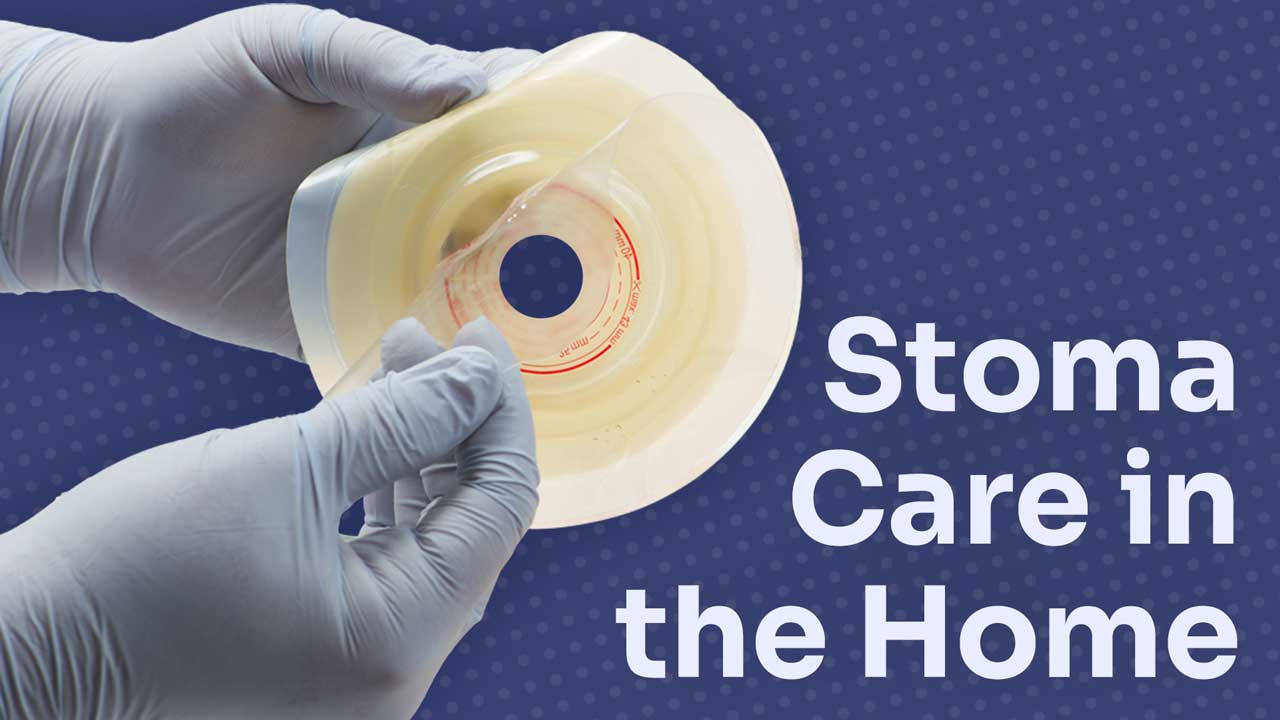 Cover image for: Stoma Care in the Home