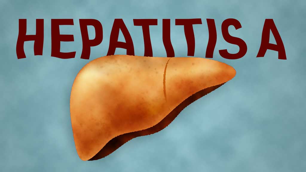 Cover image for: Hepatitis A Virus (HAV)