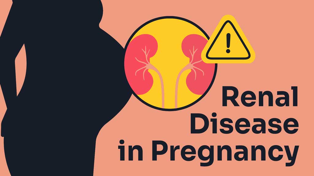 Cover image for: The Effects of Renal Disease in Pregnancy