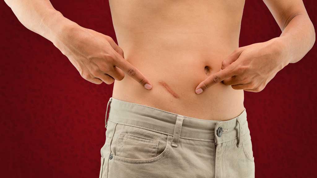 Cover image for: Appendicitis: Recognising the Signs