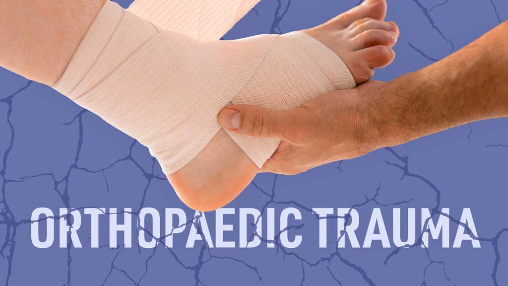 Cover image for: Orthopaedic Trauma: An Overview