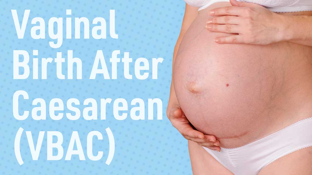 Cover image for: Vaginal Birth After Caesarean (VBAC)